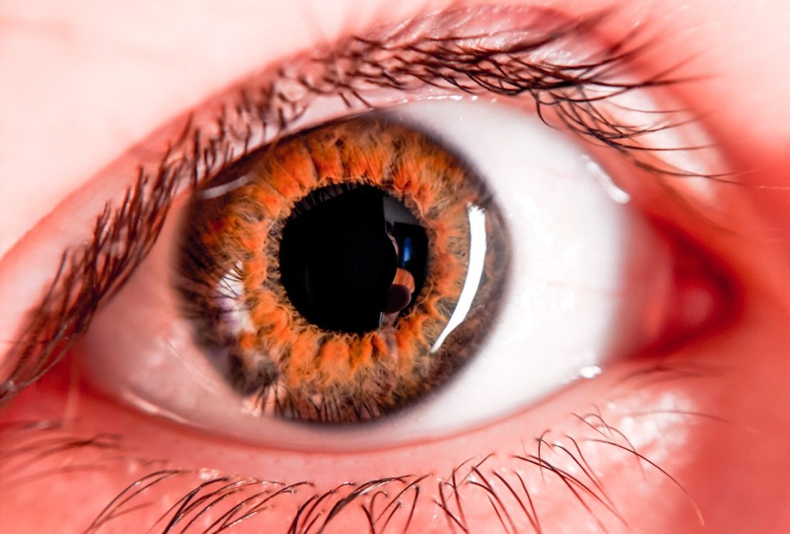 celebrities with sanpaku eyes