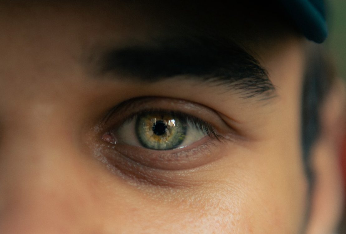 Sanpaku Eyes