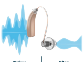 Tinnitus hearing aid