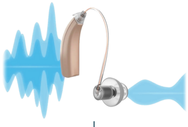 Tinnitus hearing aid